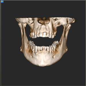 Cone Beam Tomografia Computerizzata Dentale